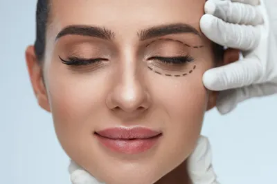 Blefaroplastia no Rio de Janeiro