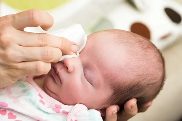 obstrução lacrimal em bebês